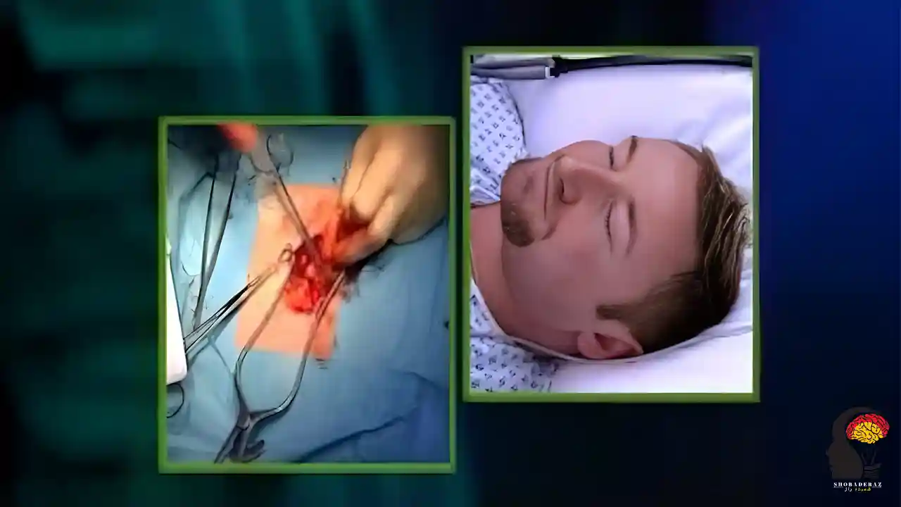 استفاده هیپنوتیزم در جراحی